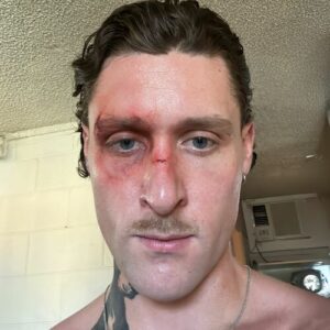 It Gets Better (Forever Mix) از KETTAMA