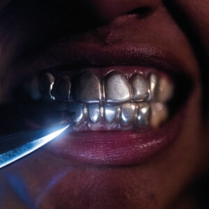 New Case از Upchuck