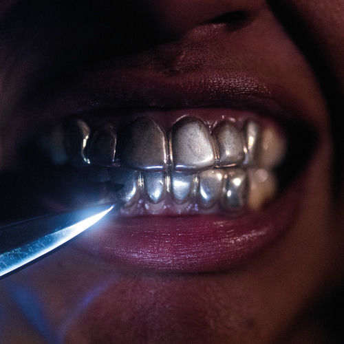 New Case از Upchuck